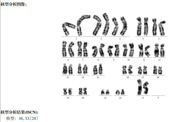 血常规用什么仪器检查患者入院要求弃胎，万万没想到血常规竟隐藏了 1 个致命信号！_https://www.jmylbn.com_新闻资讯_第11张