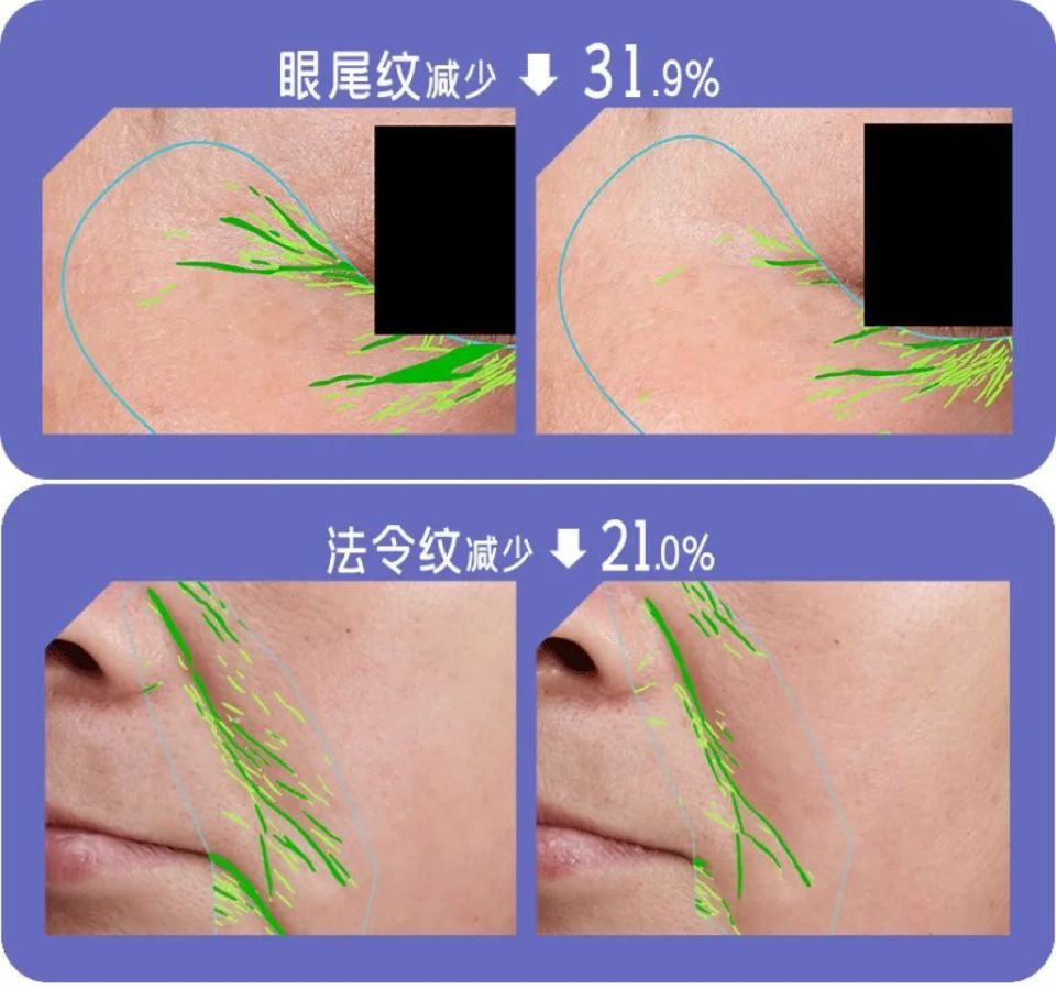 不想一个夏天老三岁,这件事就要早做(不是防晒