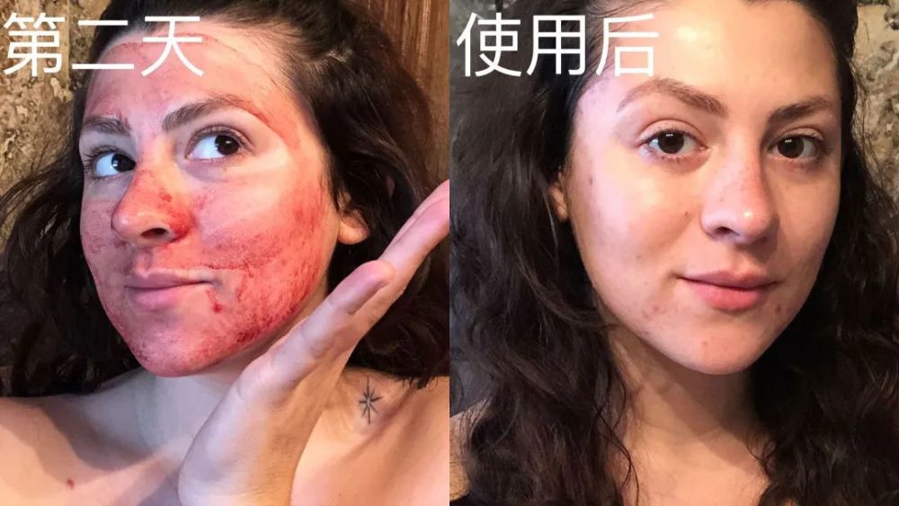 国外护肤野路子:月经血敷脸(我目瞪口呆01)_腾讯新闻