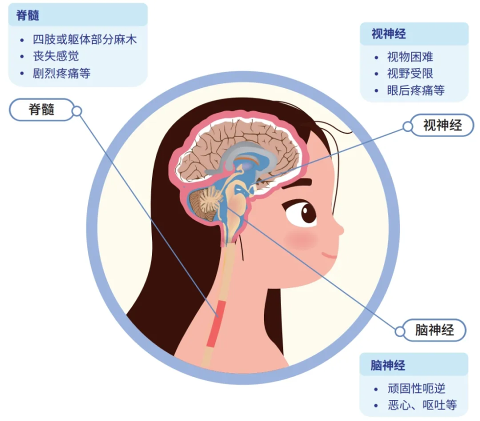 脑干位置图片