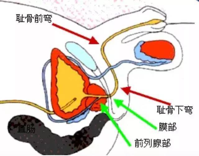 最全导尿经验分享