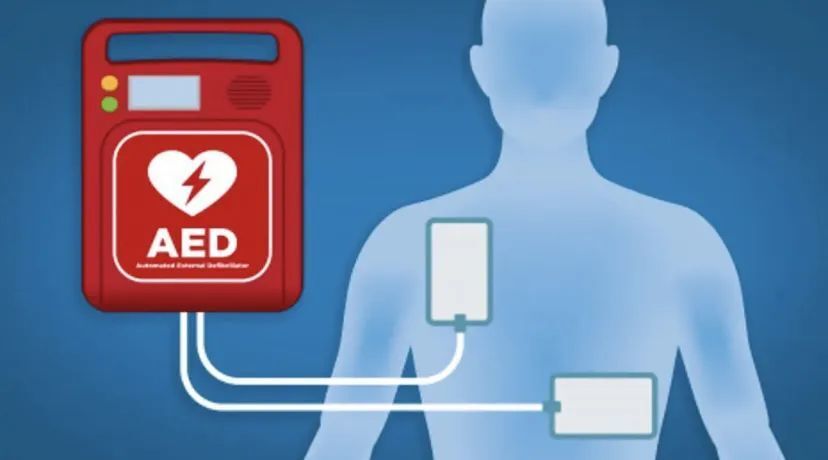 aed除颤仪为什么很贵抢救心脏病的AED除颤仪，其实没那么贵_https://www.jmylbn.com_新闻资讯_第3张