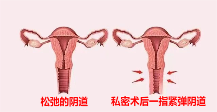 打开天窗说亮话!听正规三甲医院聊聊私密整形