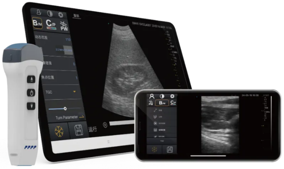 体疗器械分为什么14款高端医疗器械寻经销商，涉数字医疗影像、诊疗一体机、便携设备等领域【动脉网供需链接精选】_https://www.jmylbn.com_新闻资讯_第3张