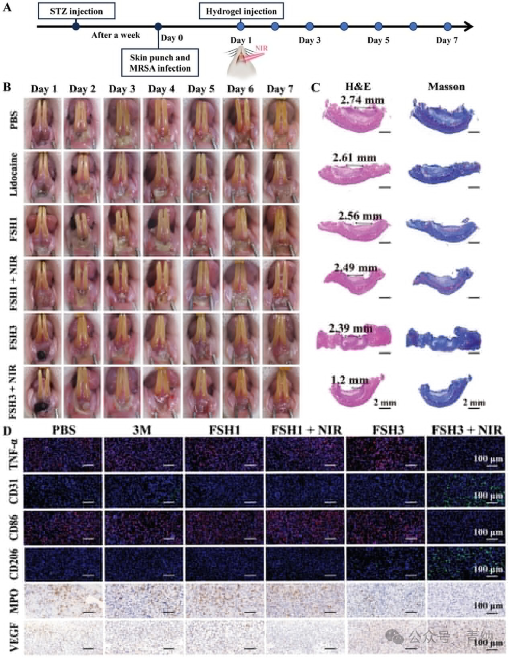 抗菌水凝胶怎么操作《Adv. Sci.》强黏附愈合紫草素水凝胶的糖尿病口腔溃疡治疗新方案！_https://www.jmylbn.com_新闻资讯_第9张