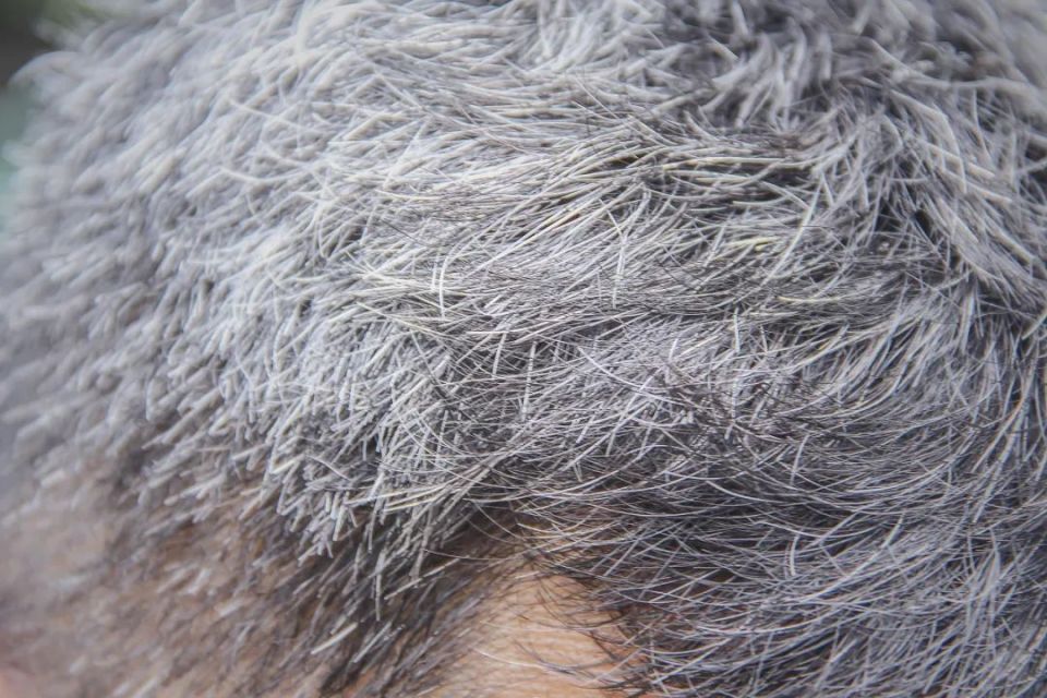 拔掉一根白头发,会长 10 根?到底要不要拔?答案是