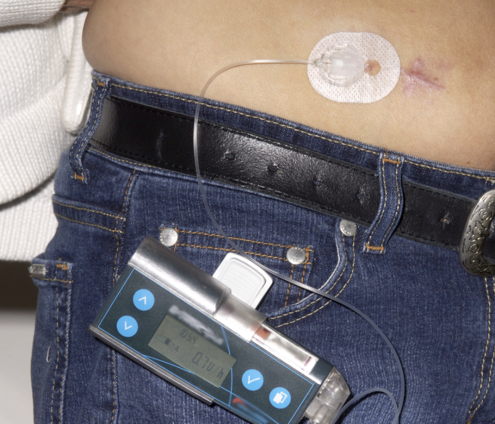 減肥藥物有哪些_內(nèi)分泌減肥藥物_藥物減肥