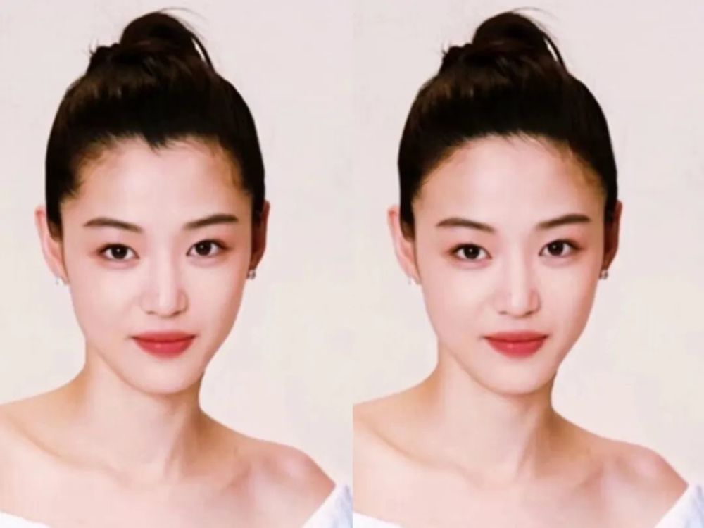 继高颅顶之后,发际线折角真的可以显脸小吗?_腾讯新闻