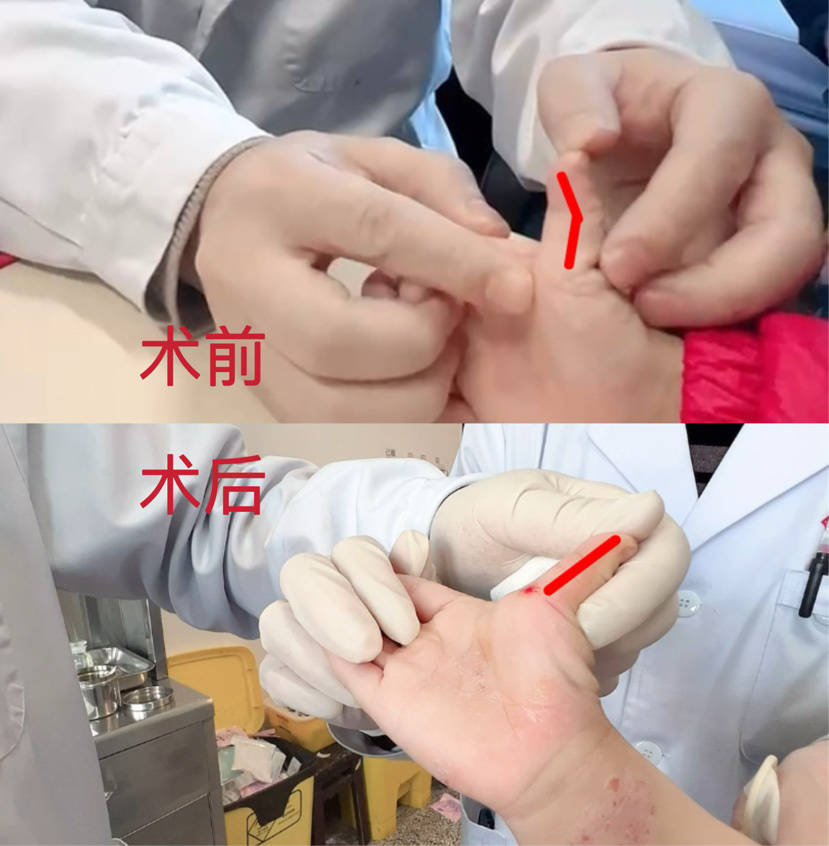 他们不禁赞叹中医的强大,"花那么少的钱,有那么快的疗效,我们没有白跑