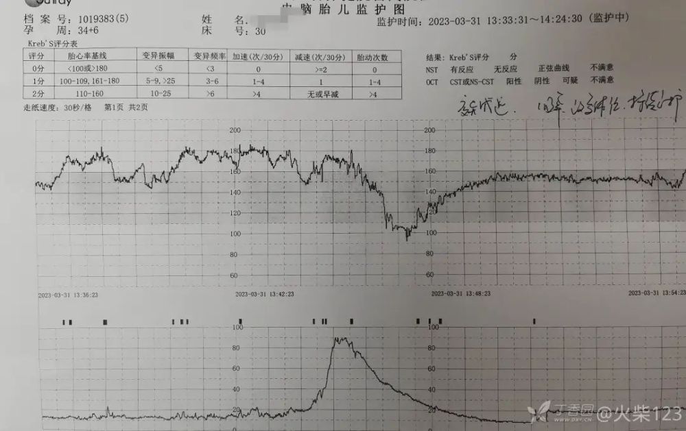 宫缩后频繁出现晚期减速,患者拒绝剖宫产,怎么办?_腾讯新闻