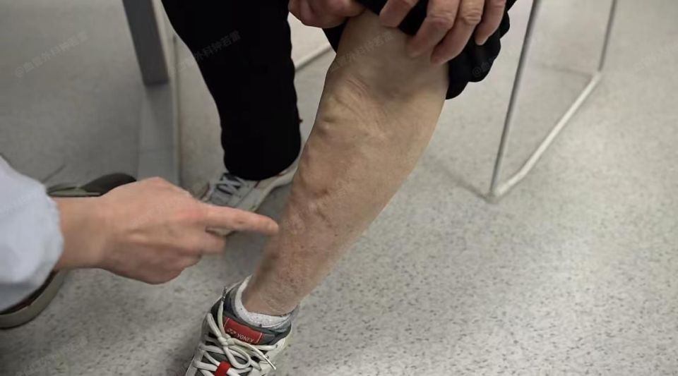 我告诉她医学上称"灌铅感".