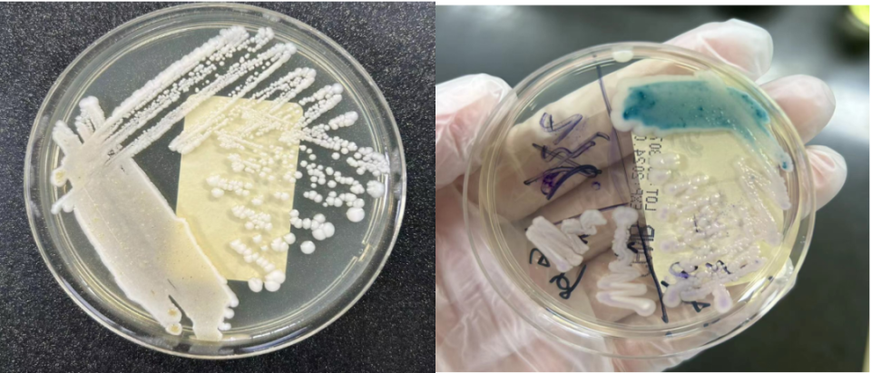 粪便常规仪器怎么用粪便中的繁星点点_https://www.jmylbn.com_新闻资讯_第5张