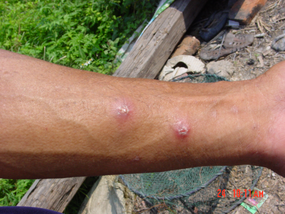 警惕!红火蚁进入活跃期,二十年已入侵我国12省未遇天敌_腾讯新闻