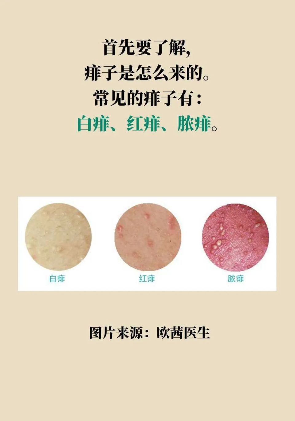 长期扑痱子粉会致癌?祛痱止痒的正确做法在此