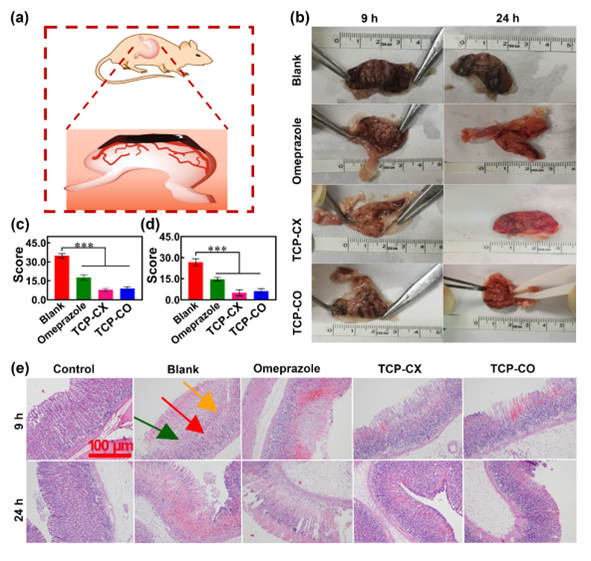 生物止血膜有哪些福州大学／中科院物构所《AFM》：生物启发的自愈性水凝胶，实现胃溃疡快速止血与促进伤口愈合_https://www.jmylbn.com_新闻资讯_第8张