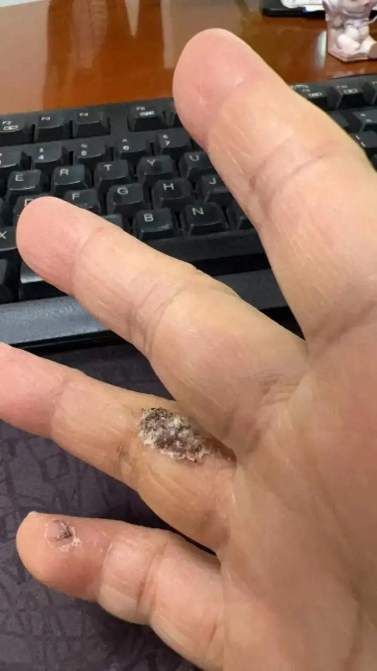 上海有医院一天看诊500人次…医生提醒