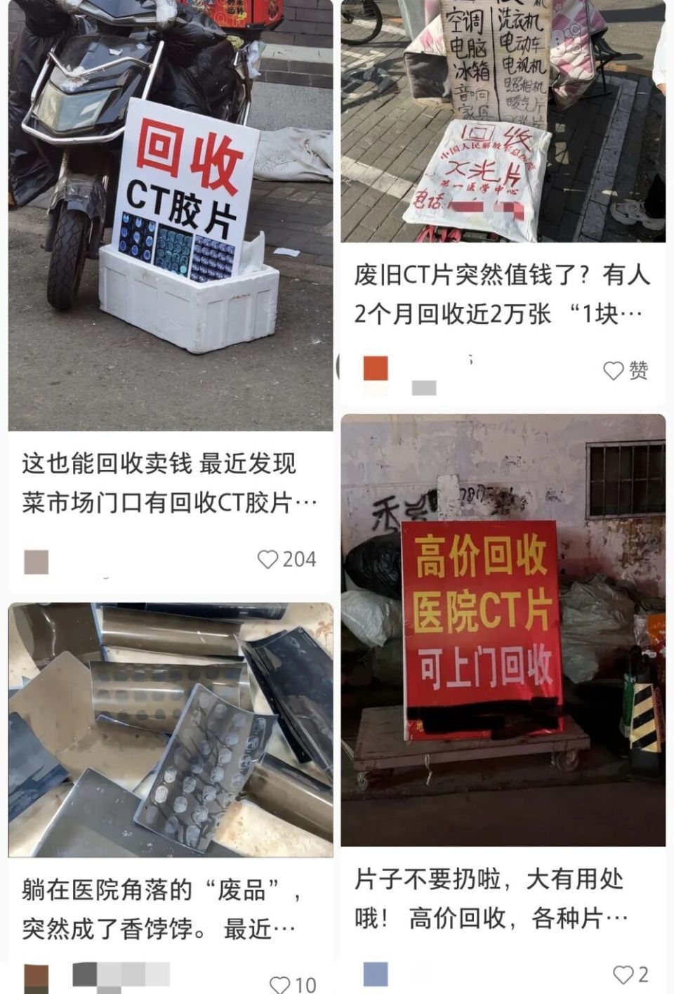 医用胶片分哪些厂家“每张能赚1块钱”，有人最近收了两万张！不少人家里都有，专家：别卖_https://www.jmylbn.com_新闻资讯_第4张