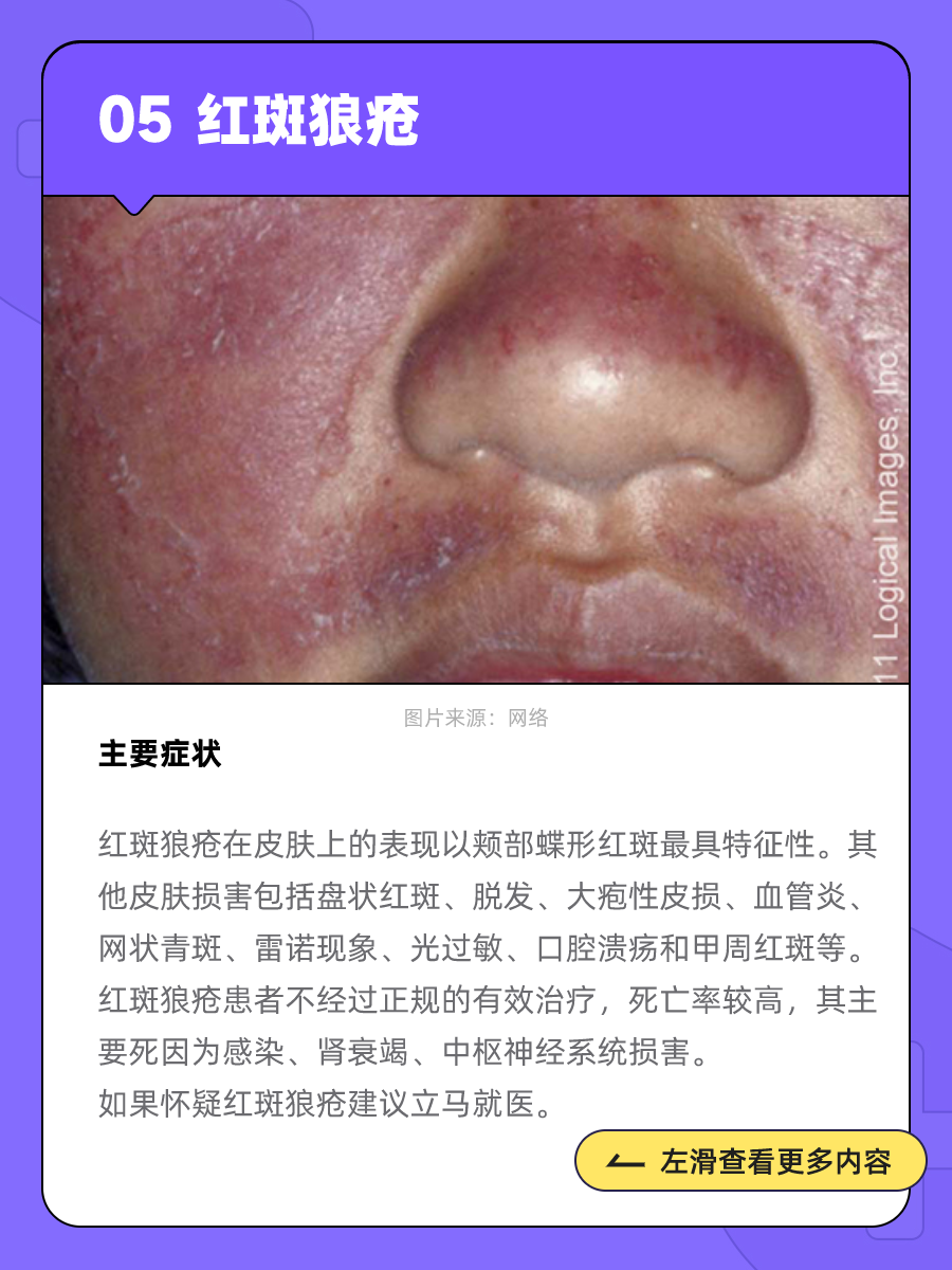 为什么脸会泛红发痒百科在线