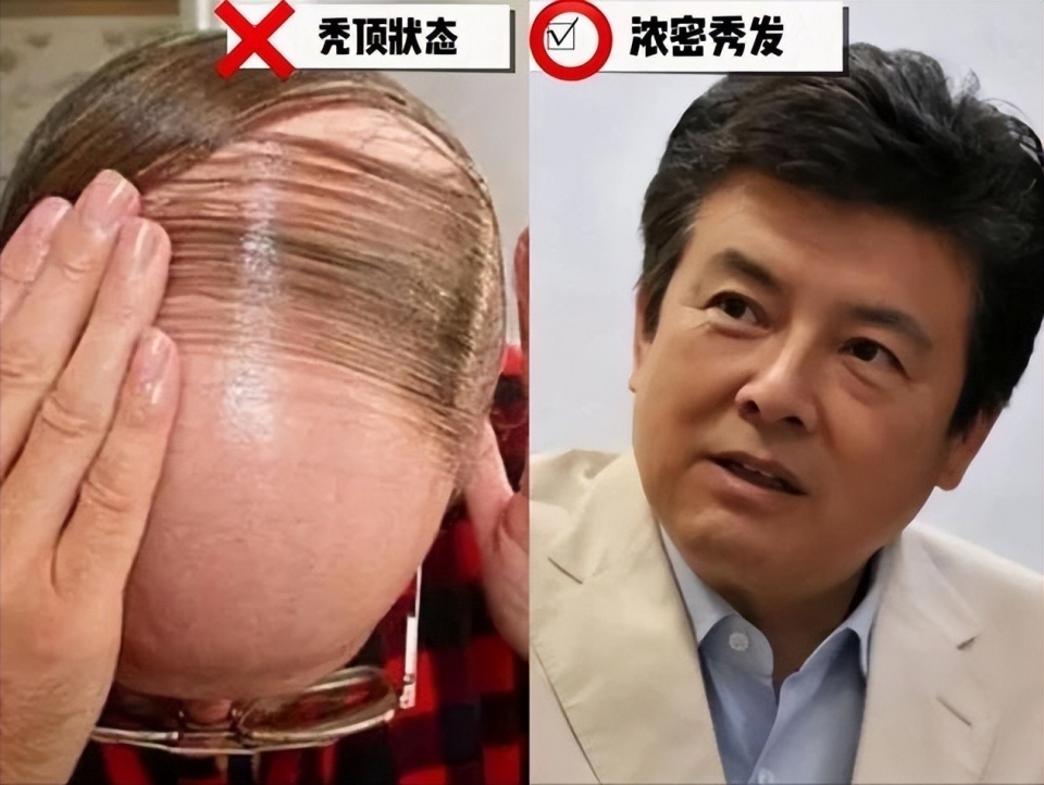 看了三浦友和打扮我悟了:西装革履不老气,发型蓬松不塌扁帅极了_腾讯