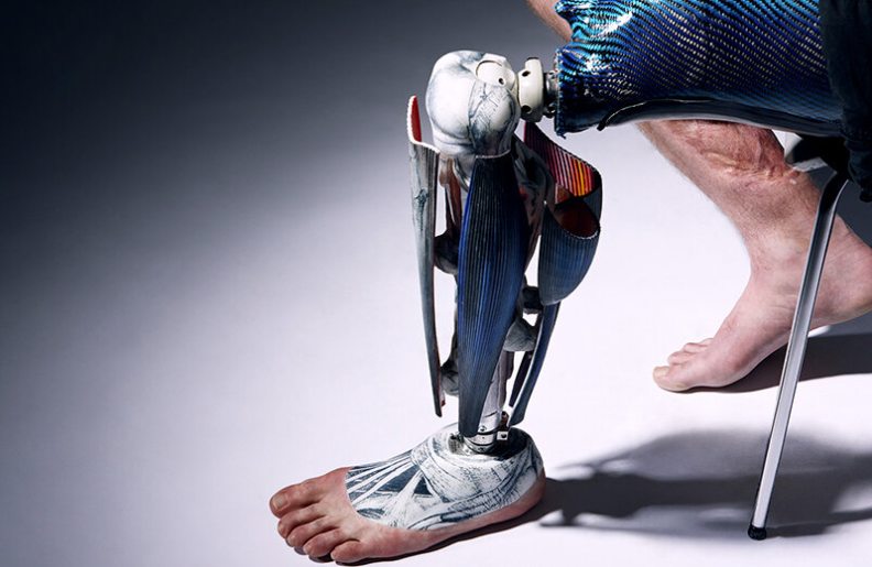 构想假肢作为可穿戴艺术作品的"解剖腿"苏菲·德·奥利维拉·巴拉塔