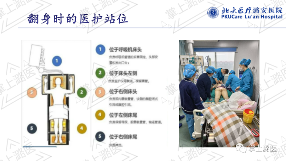 【ppt】俯卧位通气的护理