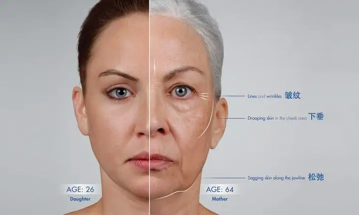 祛除眼袋,真正靠谱的办法有哪些?