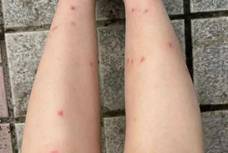 这些烦人的小虫子又来啦这种不明飞虫叫做"蓟马"多出现在春,夏季20