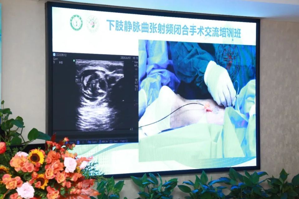 介入诊疗中心医生崔志强,张甜甜,段珍珍进行了三种不同类型下肢静脉