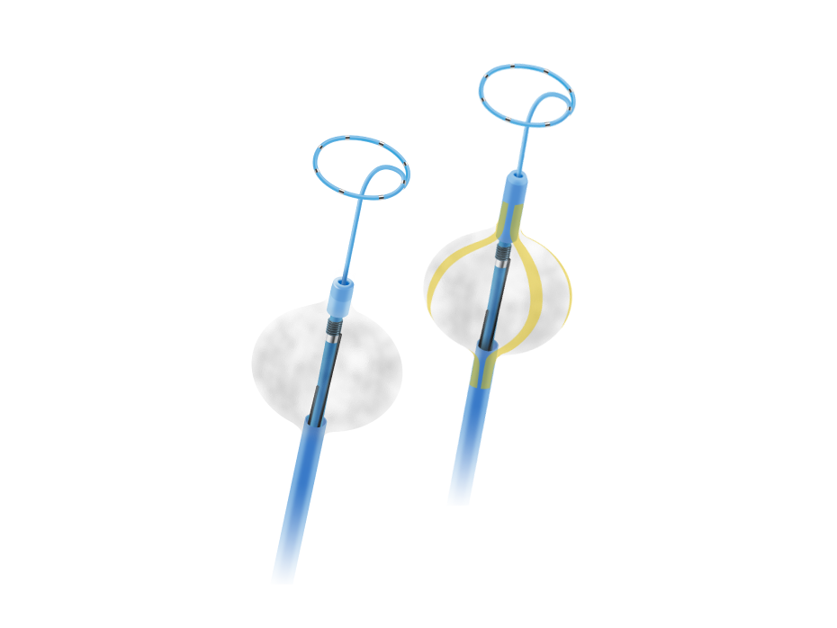 什么是创新医疗器械盘点2023获批创新医械（心血管篇）_https://www.jmylbn.com_新闻资讯_第8张