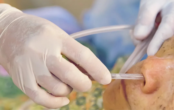 为什么要用一次性吸痰器银龄健康 ｜ 老人鼻饲饮食中防止呛咳与窒息的方法_https://www.jmylbn.com_新闻资讯_第3张