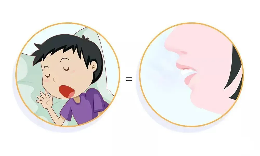 "口呼吸"影响的不只是颜值_腾讯新闻