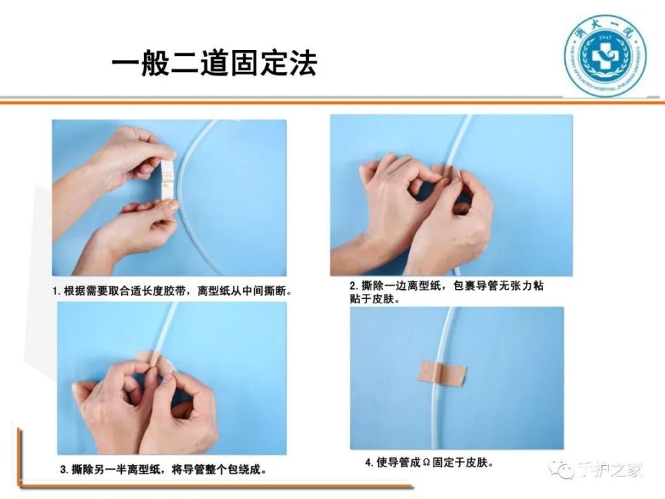 各类导管固定全攻略,一篇搞定!