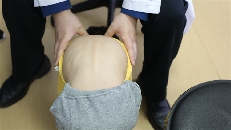 多数脊柱侧弯可以通过早期干预纠正以防止畸形加重,青少年应增强脊柱