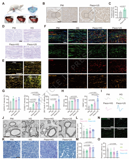 上海交大六院钱运《自然·通讯》：新型压电水凝胶生物电子学实现神经再生_腾讯新闻
