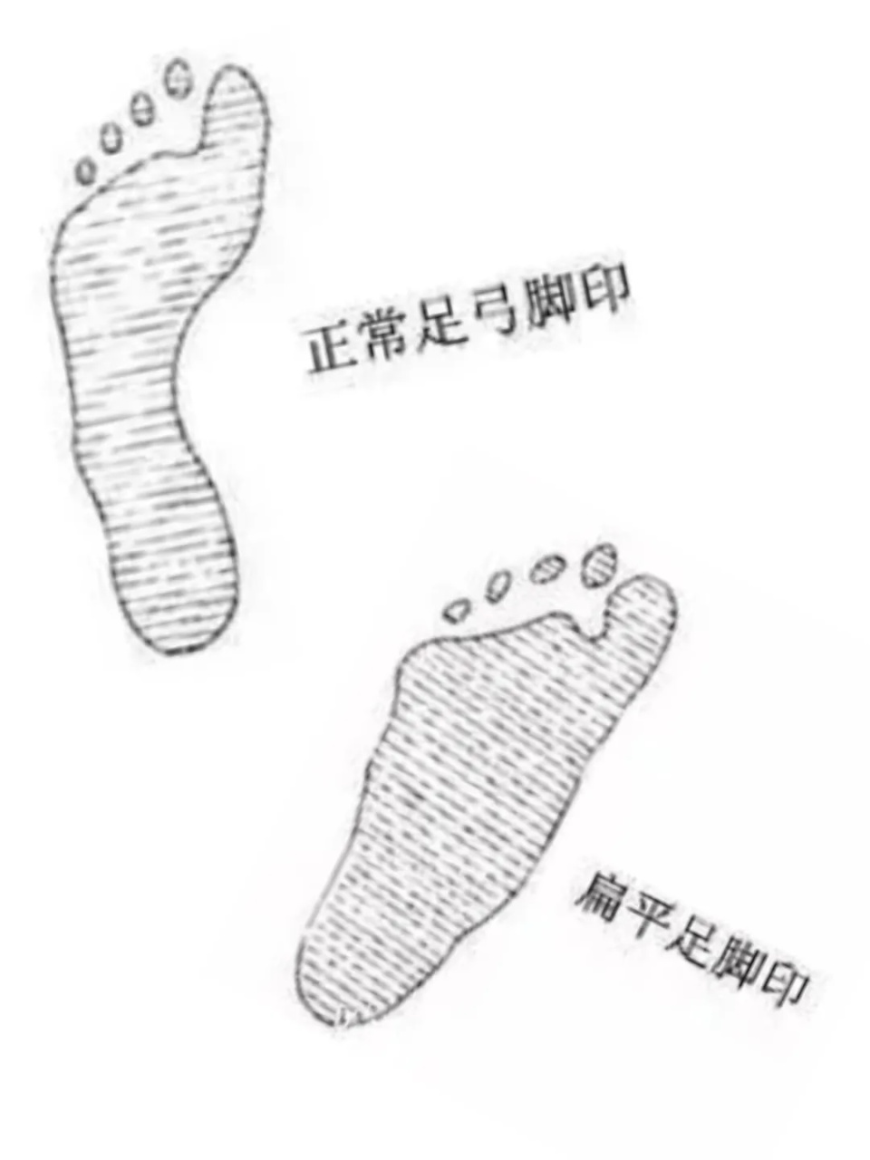 经常腰痛的人要看看脚!病根可能在这里!缓解方法在文内