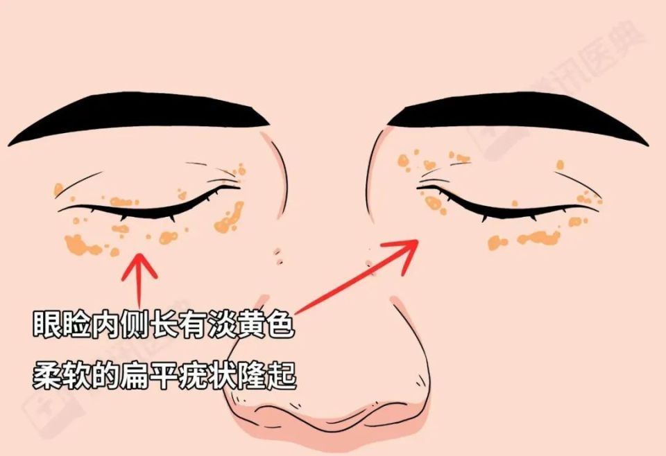 出现这6种"面相",千万别忽视!可能是疾病的征兆