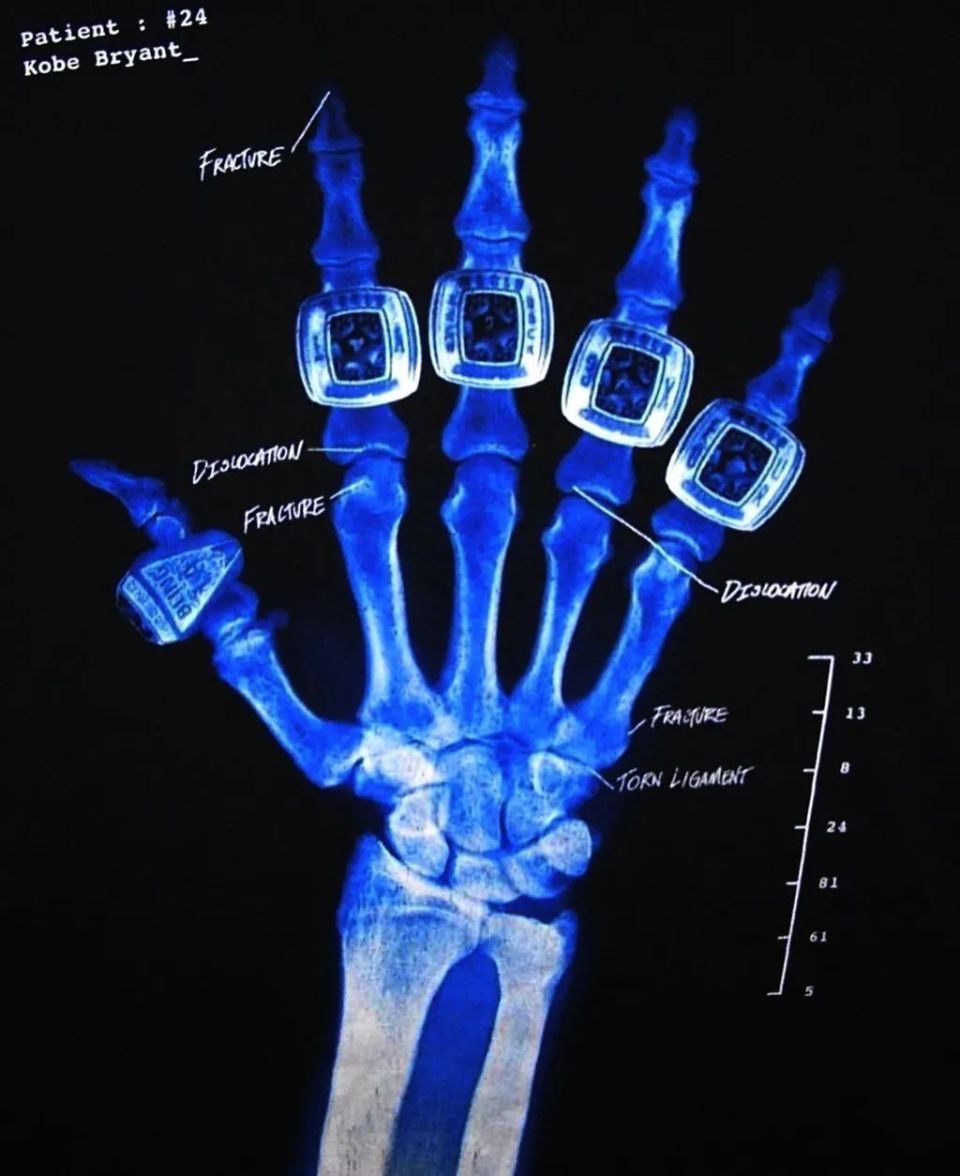 nike「科比复刻计划」大量更新!真正的 "大招" 还在后面