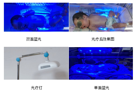 光疗时为什么黑眼罩【科普作品推荐】什么样的“光”能退黄_https://www.jmylbn.com_新闻资讯_第7张