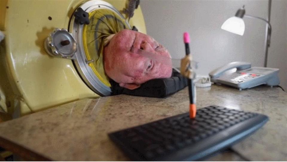 最后的铁肺人去世患小儿麻痹症被困铁皮棺材70多年用嘴敲键盘写下自传