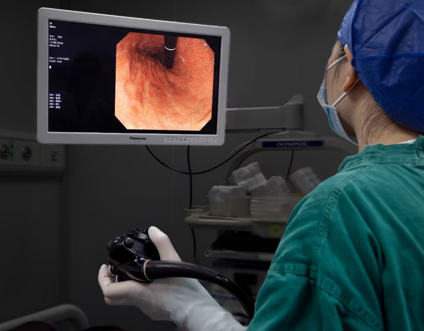 胃镜检查的事,一文知晓