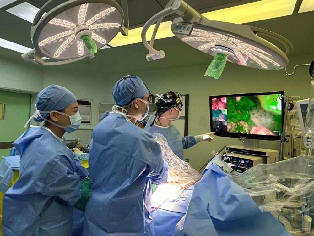 这是首例使用icg(吲哚菁绿)荧光腔镜进行桥血管评估的微创搭桥手术