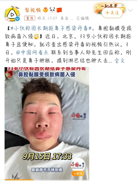 小伙称长期抠鼻子感染丹毒_腾讯新闻