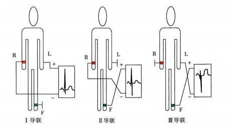 三导联示意图图片