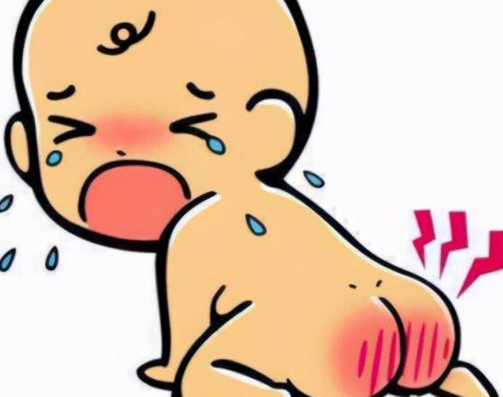 1个月宝宝屁股红肿突起 竟是肛瘘"作祟"