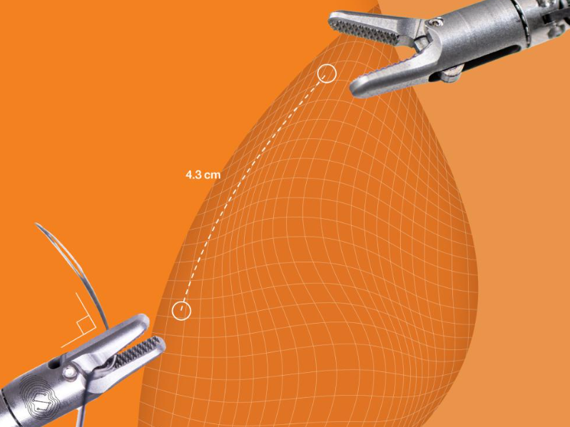 storz器械为什么好“达芬奇终结者”，面临破产？_https://www.jmylbn.com_新闻资讯_第8张