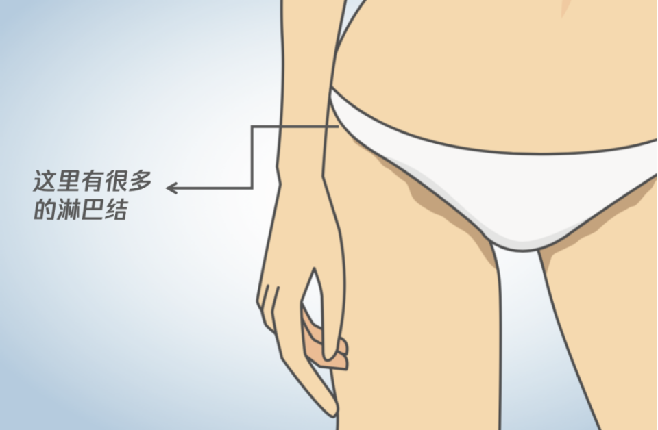 女生下体三角区长了"小疙瘩",可能不是妇科病而是淋巴结肿大