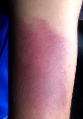 孙子在托管机构被打,爷爷奶奶心疼不已,儿子:这是我的教育方式