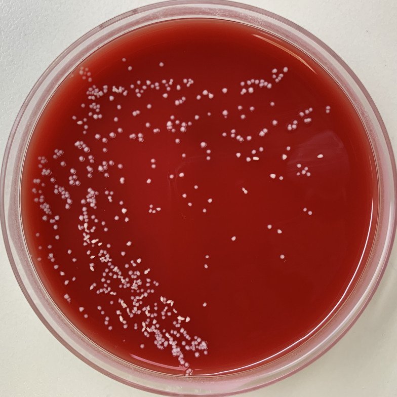 红色毛癣菌菌落图片