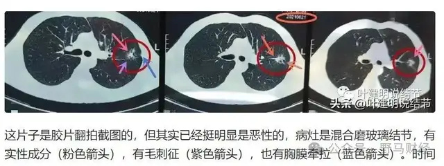血沉质控都有哪些品牌爱康国宾二次声明“漏癌”无责，女律师发出7大灵魂拷问_https://www.jmylbn.com_新闻资讯_第7张
