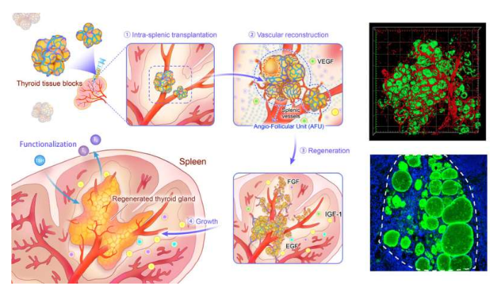 adv sci | 南京大學科學家有望在脾臟內再生甲狀腺組織_騰訊新聞